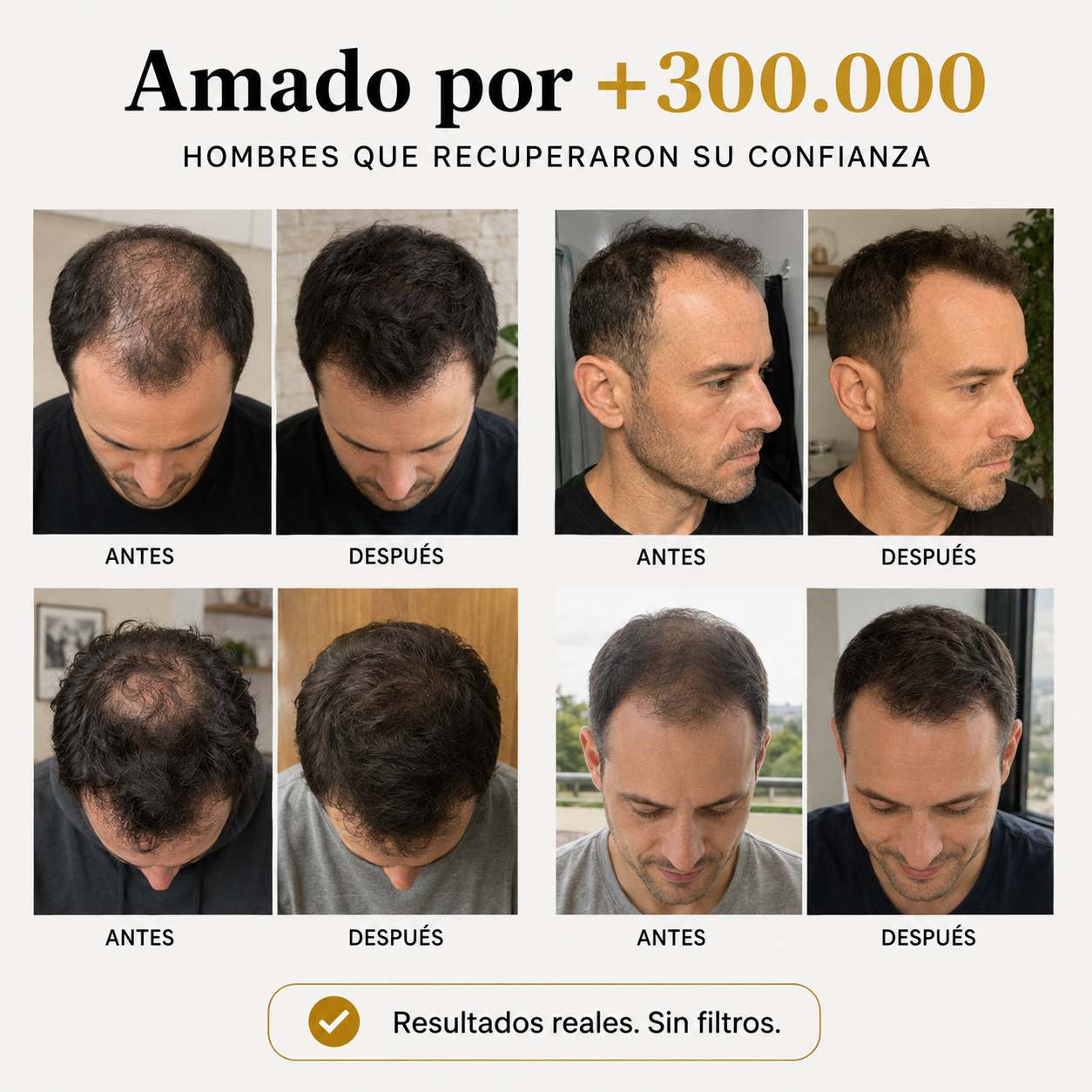 Shampoo Sólido para Crecimiento Capilar | Iron Roots